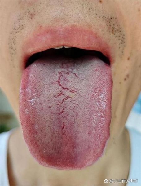 男生吐舌头是什么心理_男生吐舌头暗示什么